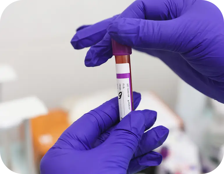 Why blood testing is a key part of preventative healthcare