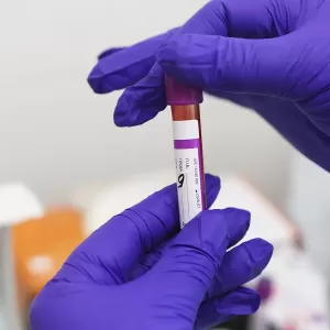 Why blood testing is a key part of preventative healthcare